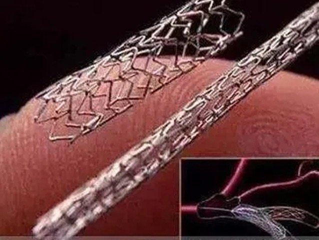 派瑞林Parylene涂层用于血管支架的防护作用图2