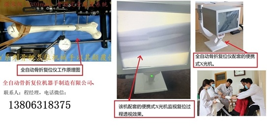 全自动智能骨伤复位机器手制造销售有限公司